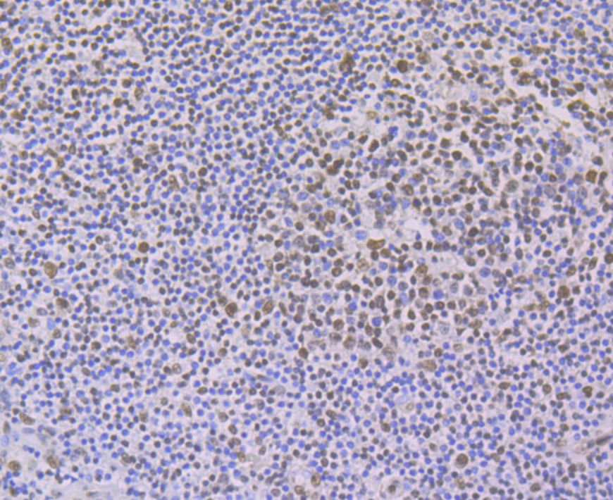 Immunohistochemical analysis of paraffin-embedded human tonsil tissue using anti-PTBP1 antibody. Counter stained with hematoxylin.