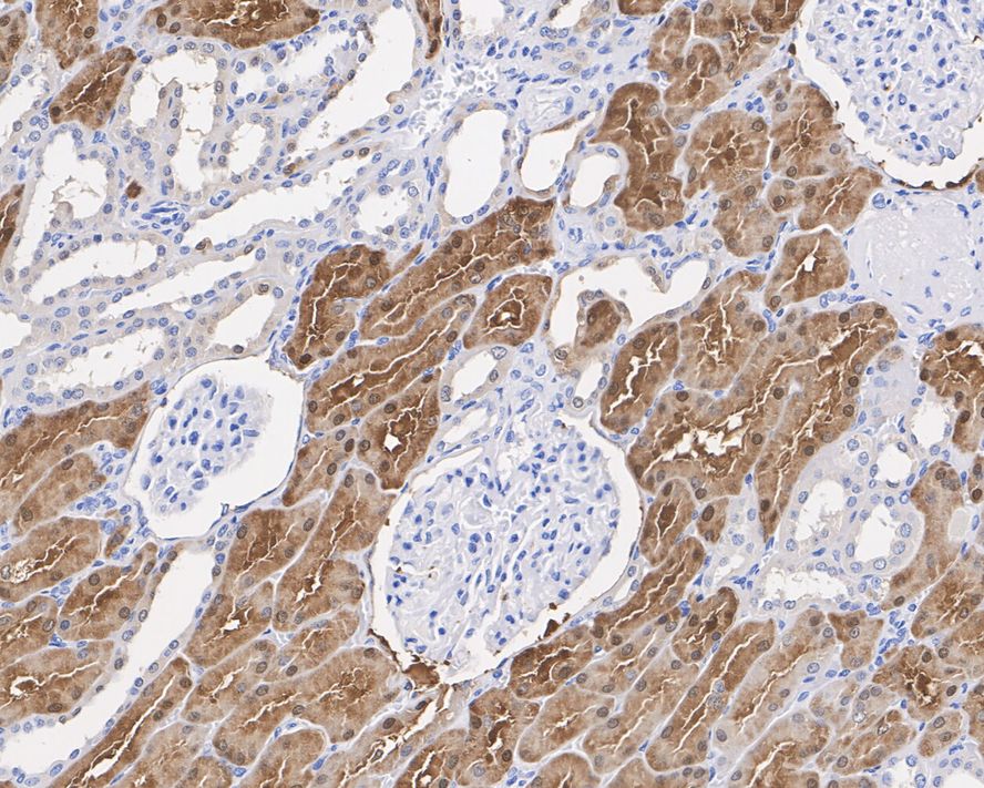Immunohistochemical analysis of paraffin-embedded human kidney tissue with Mouse anti-BHMT antibody (EM1701-64) at 1/2,000 dilution.<br />
<br />
The section was pre-treated using heat mediated antigen retrieval with Tris-EDTA buffer (pH 9.0) for 20 minutes. The tissues were blocked in 1% BSA for 20 minutes at room temperature, washed with ddH2O and PBS, and then probed with the primary antibody (EM1701-64) at 1/2,000 dilution for 1 hour at room temperature. The detection was performed using an HRP conjugated compact polymer system. DAB was used as the chromogen. Tissues were counterstained with hematoxylin and mounted with DPX.