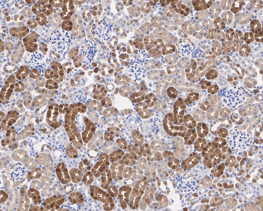 Immunohistochemical analysis of paraffin-embedded mouse kidney tissue with Mouse anti-BHMT antibody (EM1701-64) at 1/2,000 dilution.<br />
<br />
The section was pre-treated using heat mediated antigen retrieval with Tris-EDTA buffer (pH 9.0) for 20 minutes. The tissues were blocked in 1% BSA for 20 minutes at room temperature, washed with ddH2O and PBS, and then probed with the primary antibody (EM1701-64) at 1/2,000 dilution for 1 hour at room temperature. The detection was performed using an HRP conjugated compact polymer system. DAB was used as the chromogen. Tissues were counterstained with hematoxylin and mounted with DPX.
