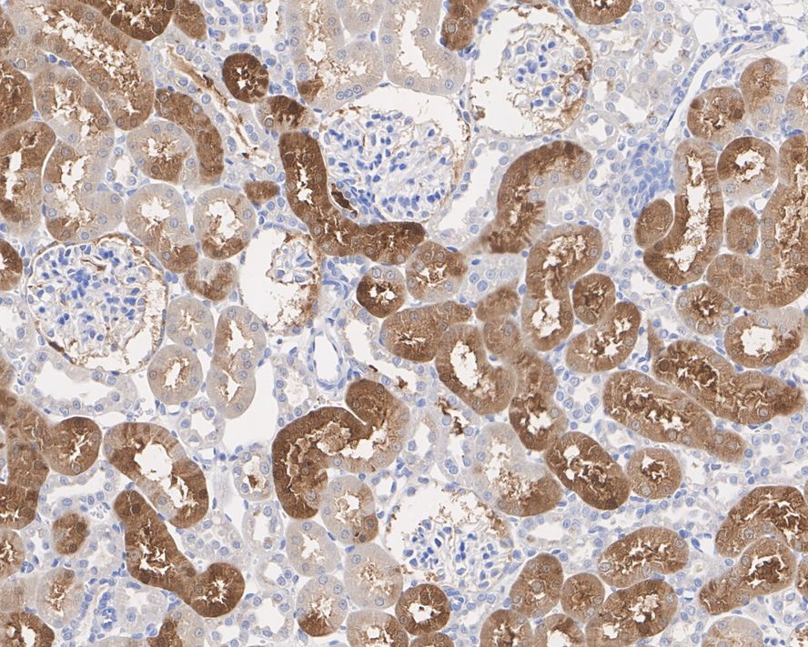 Immunohistochemical analysis of paraffin-embedded human liver tissue using anti-BHMT antibody. Counter stained with hematoxylin.