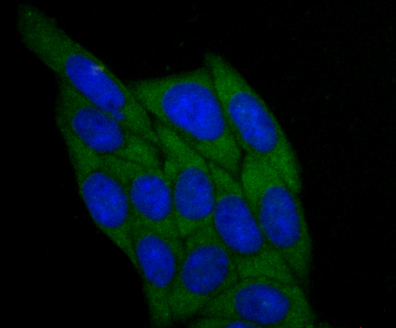 ICC staining BHMT (green) in SiHa cells. The nuclear counter stain is DAPI (blue). Cells were fixed in paraformaldehyde, permeabilised with 0.25% Triton X100/PBS.