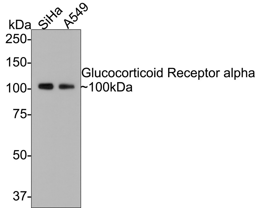 Glucocorticoid Receptor alpha Mouse Monoclonal Antibody [3F1 