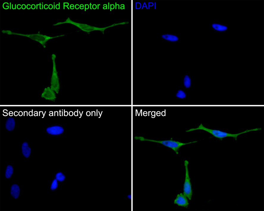 Glucocorticoid Receptor alpha Mouse Monoclonal Antibody [3F1 