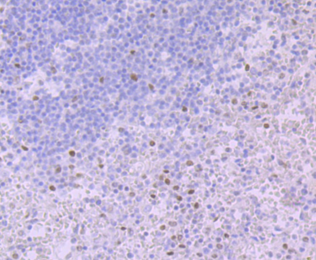 Glucocorticoid Receptor alpha Mouse Monoclonal Antibody [3F1 