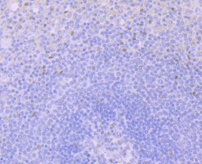 Immunohistochemical analysis of paraffin-embedded human spleen tissue using anti-Glucocorticoid Receptor alpha antibody. Counter stained with hematoxylin.