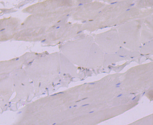 Immunohistochemical analysis of paraffin-embedded mouse smooth muscle tissue using anti-Glucocorticoid Receptor alpha antibody. Counter stained with hematoxylin.