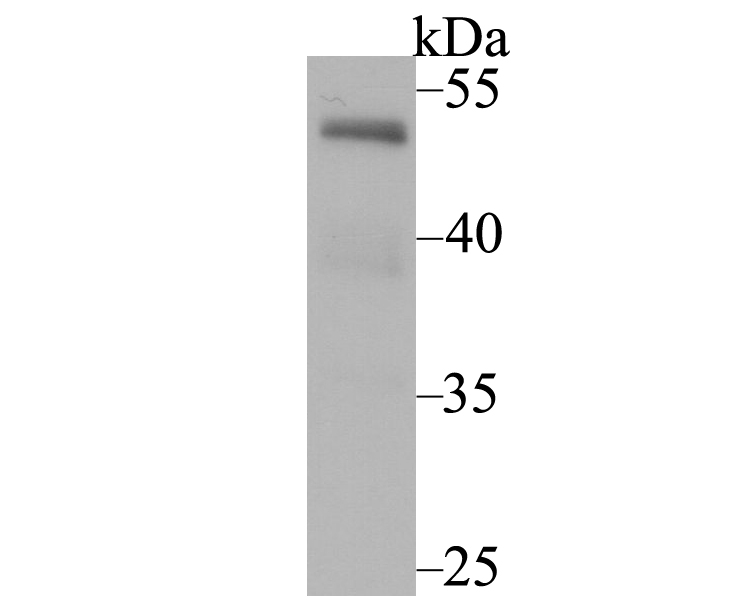 Western blot analysis of NFIB/NF1B2 on SH-SY5Y cell lysates using anti-NFIB/NF1B2 antibody at 1/1,000 dilution.