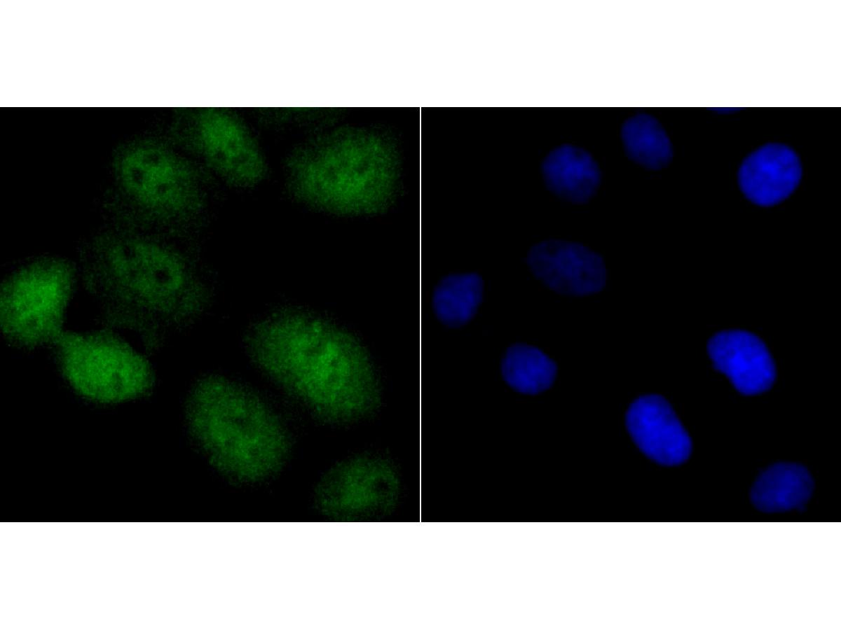 ICC staining NFIB/NF1B2 (green) in LO-2 cells. The nuclear counter stain is DAPI (blue). Cells were fixed in paraformaldehyde, permeabilised with 0.25% Triton X100/PBS.