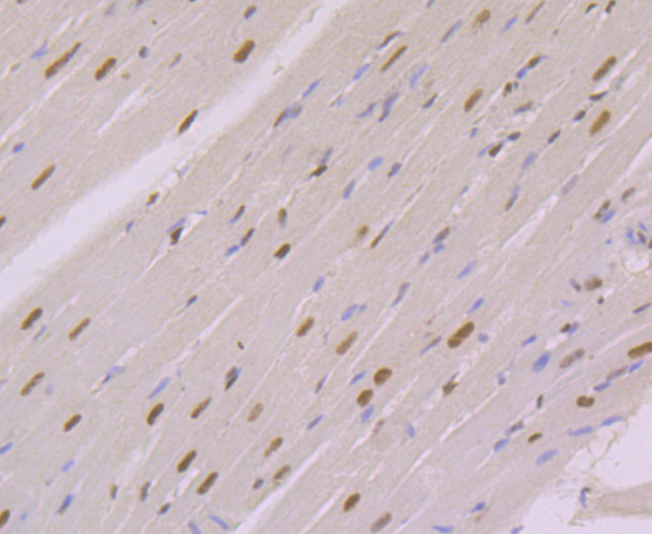 Immunohistochemical analysis of paraffin-embedded rat heart tissue using anti-NFIB/NF1B2 antibody. Counter stained with hematoxylin.