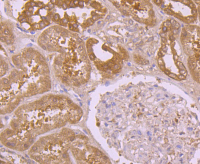 Immunohistochemical analysis of paraffin-embedded human kidney tissue using anti- Peroxiredoxin 2 antibody. Counter stained with hematoxylin.