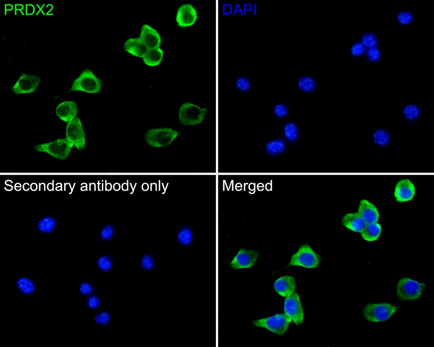 Immunocytochemistry analysis of PC-3 cells labeling PRDX2 with Mouse anti-PRDX2 antibody (EM1701-71) at 1/50 dilution.<br />
<br />
Cells were fixed in 4% paraformaldehyde for 30 minutes, permeabilized with 0.1% Triton X-100 in PBS for 15 minutes, and then blocked with 2% BSA for 30 minutes at room temperature. Cells were then incubated with Mouse anti-PRDX2 antibody (EM1701-71) at 1/100 dilution in 2% BSA overnight at 4 ℃. Goat Anti-Mouse IgG H&L (iFluor™ 488, HA1125) was used as the secondary antibody at 1/1,000 dilution. PBS instead of the primary antibody was used as the secondary antibody only control. Nuclear DNA was labelled in blue with DAPI.