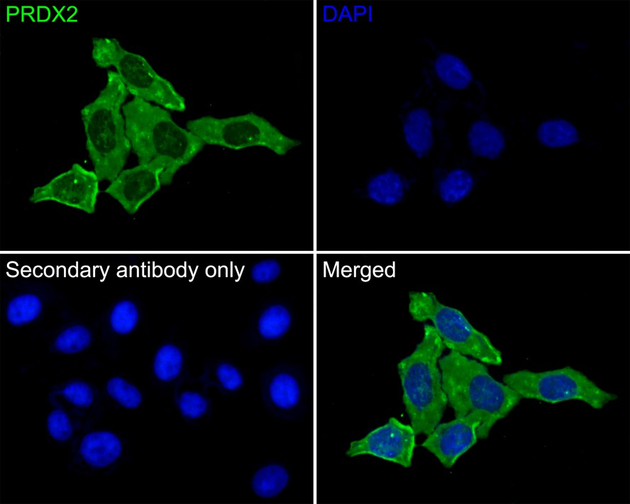 ICC staining Peroxiredoxin 2 (green) in SH-SY-5Y cells. The nuclear counter stain is DAPI (blue). Cells were fixed in paraformaldehyde, permeabilised with 0.25% Triton X100/PBS.