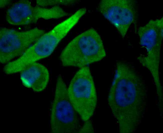 ICC staining PRDX6 (green) in PC-3M cells. The nuclear counter stain is DAPI (blue). Cells were fixed in paraformaldehyde, permeabilised with 0.25% Triton X100/PBS.