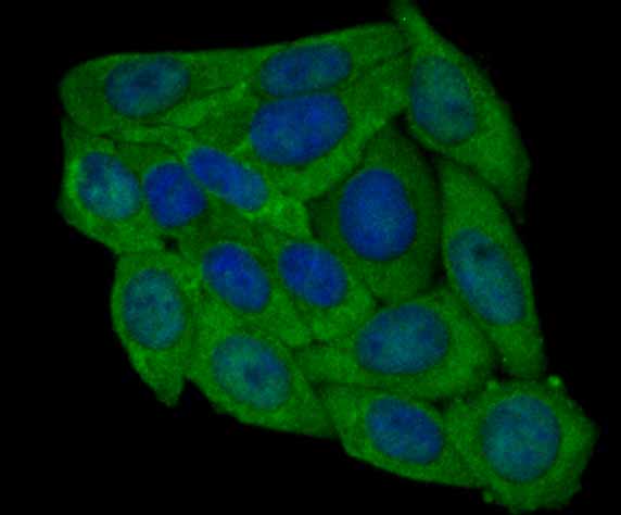 ICC staining PRDX6 (green) in SiHa cells. The nuclear counter stain is DAPI (blue). Cells were fixed in paraformaldehyde, permeabilised with 0.25% Triton X100/PBS.