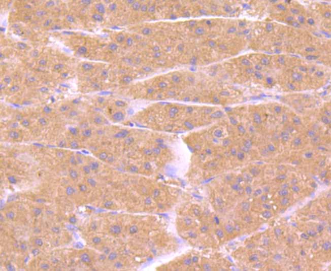 Immunohistochemical analysis of paraffin-embedded human liver tissue using anti-PRDX6 antibody. Counter stained with hematoxylin.