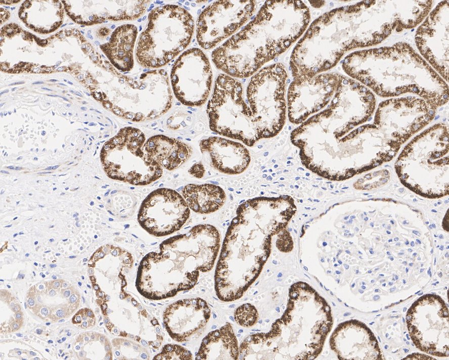 Immunohistochemical analysis of paraffin-embedded human liver tissue with Mouse anti-ALDH4A1 antibody (EM1701-74) at 1/400 dilution.<br />
<br />
The section was pre-treated using heat mediated antigen retrieval with Tris-EDTA buffer (pH 9.0) for 20 minutes. The tissues were blocked in 1% BSA for 20 minutes at room temperature, washed with ddH2O and PBS, and then probed with the primary antibody (EM1701-74) at 1/400 dilution for 1 hour at room temperature. The detection was performed using an HRP conjugated compact polymer system. DAB was used as the chromogen. Tissues were counterstained with hematoxylin and mounted with DPX.