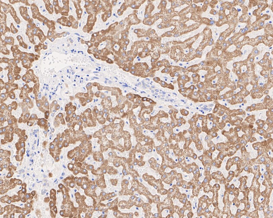 Immunohistochemical analysis of paraffin-embedded human liver tissue with Mouse anti-ALDH4A1 antibody (EM1701-74) at 1/1,000 dilution.<br />
<br />
The section was pre-treated using heat mediated antigen retrieval with Tris-EDTA buffer (pH 9.0) for 20 minutes. The tissues were blocked in 1% BSA for 20 minutes at room temperature, washed with ddH2O and PBS, and then probed with the primary antibody (EM1701-74) at 1/1,000 dilution for 1 hour at room temperature. The detection was performed using an HRP conjugated compact polymer system. DAB was used as the chromogen. Tissues were counterstained with hematoxylin and mounted with DPX.