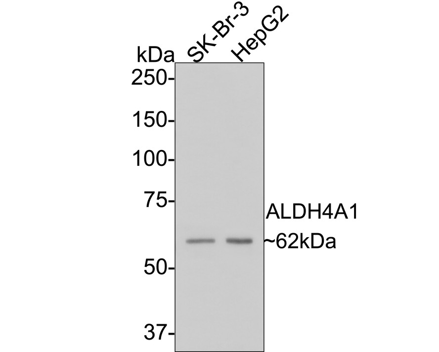 Western blot analysis of ALDH4A1 on different lysates with Mouse anti-ALDH4A1 antibody (EM1701-75) at 1/1,000 dilution.<br />
<br />
Lane 1: SK-Br-3 cell lysate<br />
Lane 2: HepG2 cell lysate<br />
<br />
Lysates/proteins at 10 µg/Lane.<br />
<br />
Predicted band size: 62 kDa<br />
Observed band size: 62 kDa<br />
<br />
Exposure time: 2 minutes;<br />
<br />
8% SDS-PAGE gel.<br />
<br />
Proteins were transferred to a PVDF membrane and blocked with 5% NFDM/TBST for 1 hour at room temperature. The primary antibody (EM1701-75) at 1/1,000 dilution was used in 5% NFDM/TBST at room temperature for 2 hours. Goat Anti-Mouse IgG - HRP Secondary Antibody (HA1006) at 1:100,000 dilution was used for 1 hour at room temperature.
