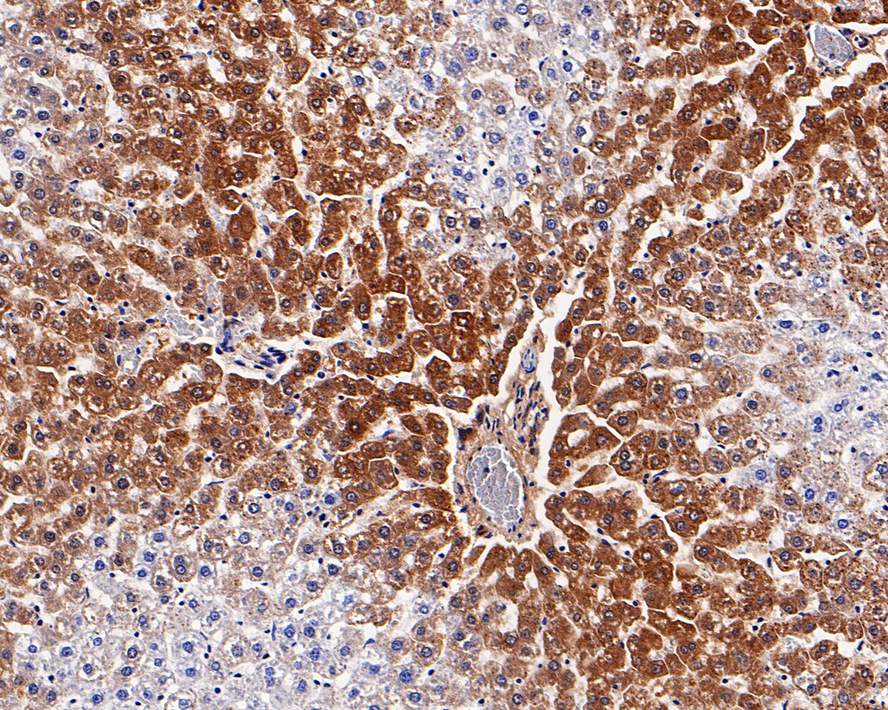 Immunohistochemical analysis of paraffin-embedded human prostate tissue using anti-ALDH4A1 antibody. Counter stained with hematoxylin.