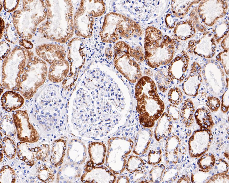 Immunohistochemical analysis of paraffin-embedded human kidney tissue with Mouse anti-ALDH4A1 antibody (EM1701-75) at 1/400 dilution.<br />
<br />
The section was pre-treated using heat mediated antigen retrieval with Tris-EDTA buffer (pH 9.0) for 20 minutes. The tissues were blocked in 1% BSA for 20 minutes at room temperature, washed with ddH2O and PBS, and then probed with the primary antibody (EM1701-75) at 1/400 dilution for 1 hour at room temperature. The detection was performed using an HRP conjugated compact polymer system. DAB was used as the chromogen. Tissues were counterstained with hematoxylin and mounted with DPX.