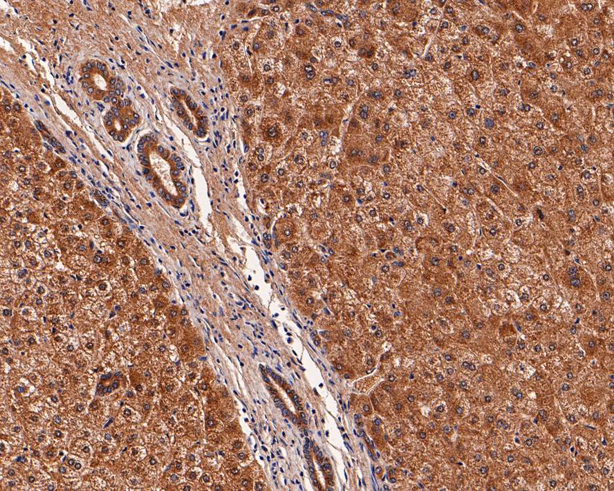 Immunohistochemical analysis of paraffin-embedded human liver tissue with Mouse anti-UGP2 antibody (EM1701-76) at 1/400 dilution.<br />
<br />
The section was pre-treated using heat mediated antigen retrieval with Tris-EDTA buffer (pH 9.0) for 20 minutes. The tissues were blocked in 1% BSA for 20 minutes at room temperature, washed with ddH2O and PBS, and then probed with the primary antibody (EM1701-76) at 1/400 dilution for 1 hour at room temperature. The detection was performed using an HRP conjugated compact polymer system. DAB was used as the chromogen. Tissues were counterstained with hematoxylin and mounted with DPX.