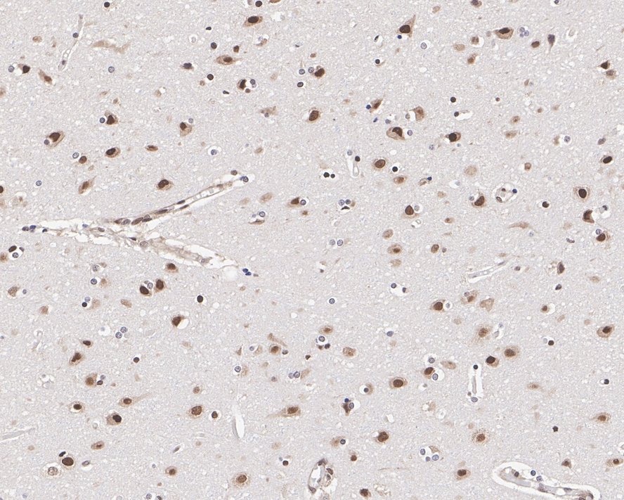 Immunohistochemical analysis of paraffin-embedded human brain tissue with Mouse anti-CELF-1 antibody (EM1701-77) at 1/400 dilution.<br />
<br />
The section was pre-treated using heat mediated antigen retrieval with sodium citrate buffer (pH 6.0) for 2 minutes. The tissues were blocked in 1% BSA for 20 minutes at room temperature, washed with ddH2O and PBS, and then probed with the primary antibody (EM1701-77) at 1/400 dilution for 1 hour at room temperature. The detection was performed using an HRP conjugated compact polymer system. DAB was used as the chromogen. Tissues were counterstained with hematoxylin and mounted with DPX.