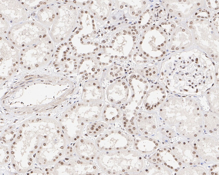 Immunohistochemical analysis of paraffin-embedded human kidney tissue with Mouse anti-CELF-1 antibody (EM1701-77) at 1/400 dilution.<br />
<br />
The section was pre-treated using heat mediated antigen retrieval with sodium citrate buffer (pH 6.0) for 2 minutes. The tissues were blocked in 1% BSA for 20 minutes at room temperature, washed with ddH2O and PBS, and then probed with the primary antibody (EM1701-77) at 1/400 dilution for 1 hour at room temperature. The detection was performed using an HRP conjugated compact polymer system. DAB was used as the chromogen. Tissues were counterstained with hematoxylin and mounted with DPX.