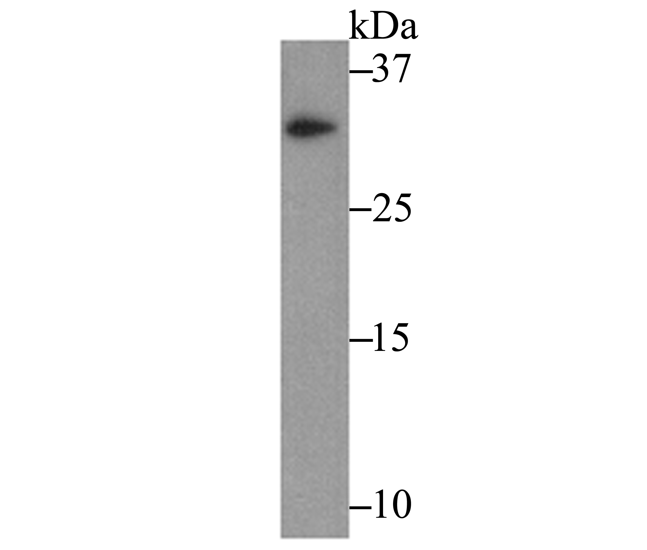 Western blot analysis of IL-31 on recombinant protein lysate using anti-IL-31 antibody at 1/500 dilution.