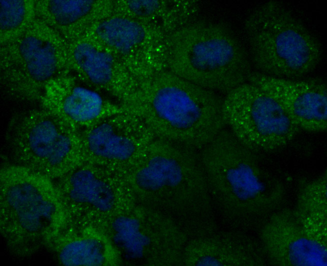 ICC staining IL-31 (green) in A431 cells. The nuclear counter stain is DAPI (blue). Cells were fixed in paraformaldehyde, permeabilised with 0.25% Triton X100/PBS.