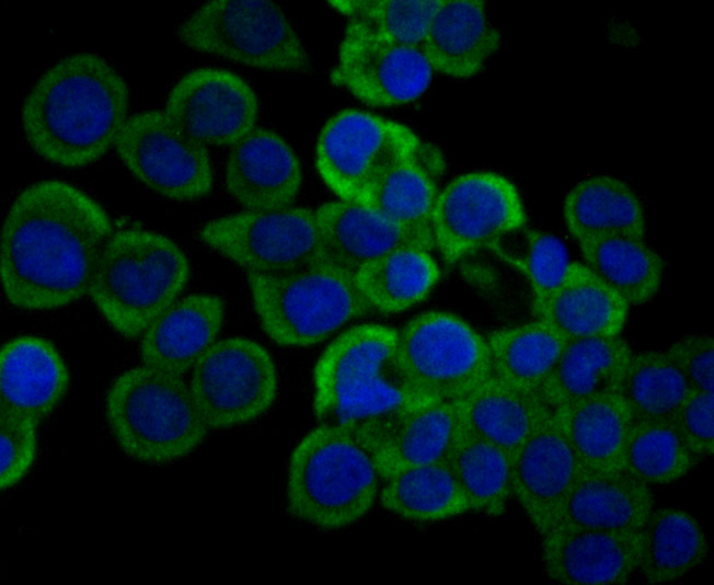 ICC staining IL-31 (green) in LOVO cells. The nuclear counter stain is DAPI (blue). Cells were fixed in paraformaldehyde, permeabilised with 0.25% Triton X100/PBS.