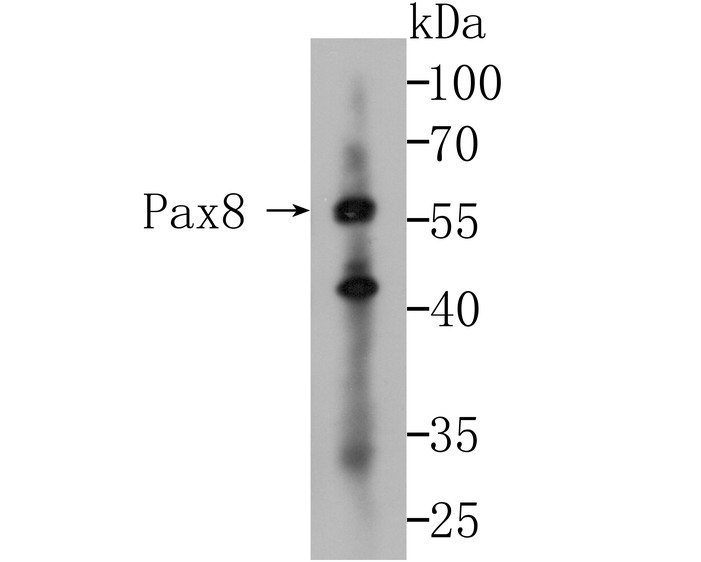Western blot analysis of Pax8 on skov-3 cells lysates using anti-Pax8 antibody at 1/500 dilution.