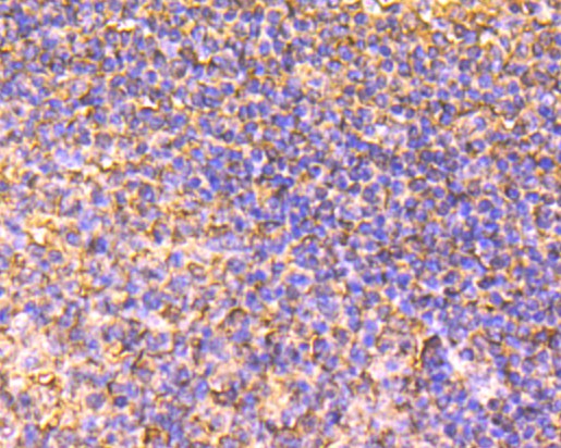 Immunohistochemical analysis of paraffin-embedded human tonsil tissue using anti-BCL2 antibody. Counter stained with hematoxylin.