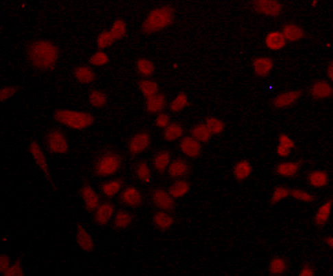 ICC staining CDCP1 (red) in A549 cells. Cells were fixed in paraformaldehyde, permeabilised with 0.25% Triton X100/PBS.