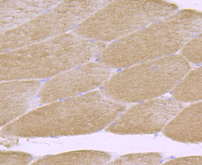 Immunohistochemical analysis of paraffin-embedded rat skeletal muscle tissue using anti-CDCP1 antibody. Counter stained with hematoxylin.