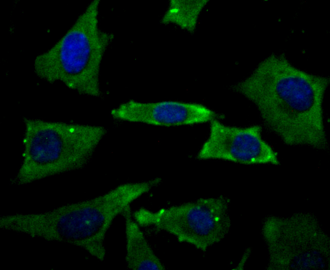 ICC staining PGP9.5 (green) in SH-SY-5Y cells. The nuclear counter stain is DAPI (blue). Cells were fixed in paraformaldehyde, permeabilised with 0.25% Triton X100/PBS.