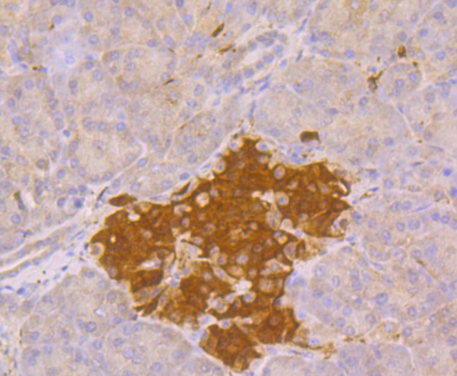 Immunohistochemical analysis of paraffin-embedded human pancreas tissue using anti-PGP9.5 antibody. Counter stained with hematoxylin.