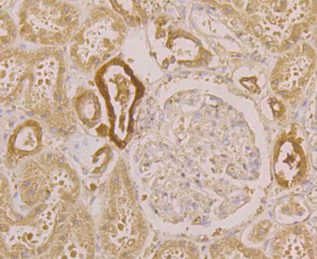 Immunohistochemical analysis of paraffin-embedded human kidney tissue using anti-PGP9.5 antibody. Counter stained with hematoxylin.
