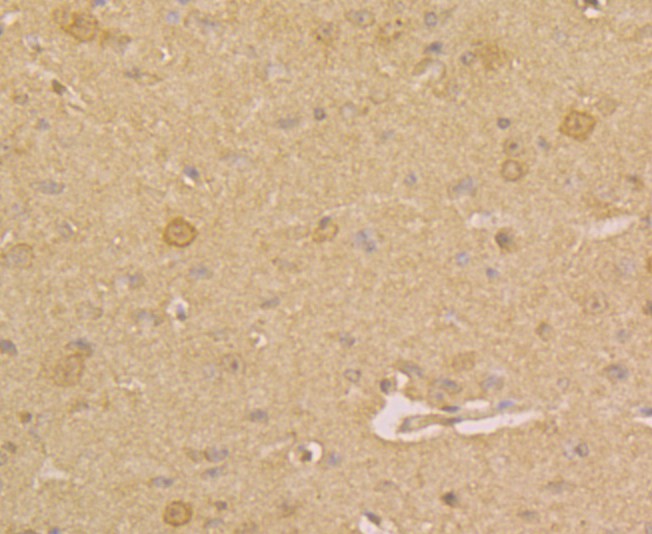 Immunohistochemical analysis of paraffin-embedded mouse brain tissue using anti-PGP9.5 antibody. Counter stained with hematoxylin.