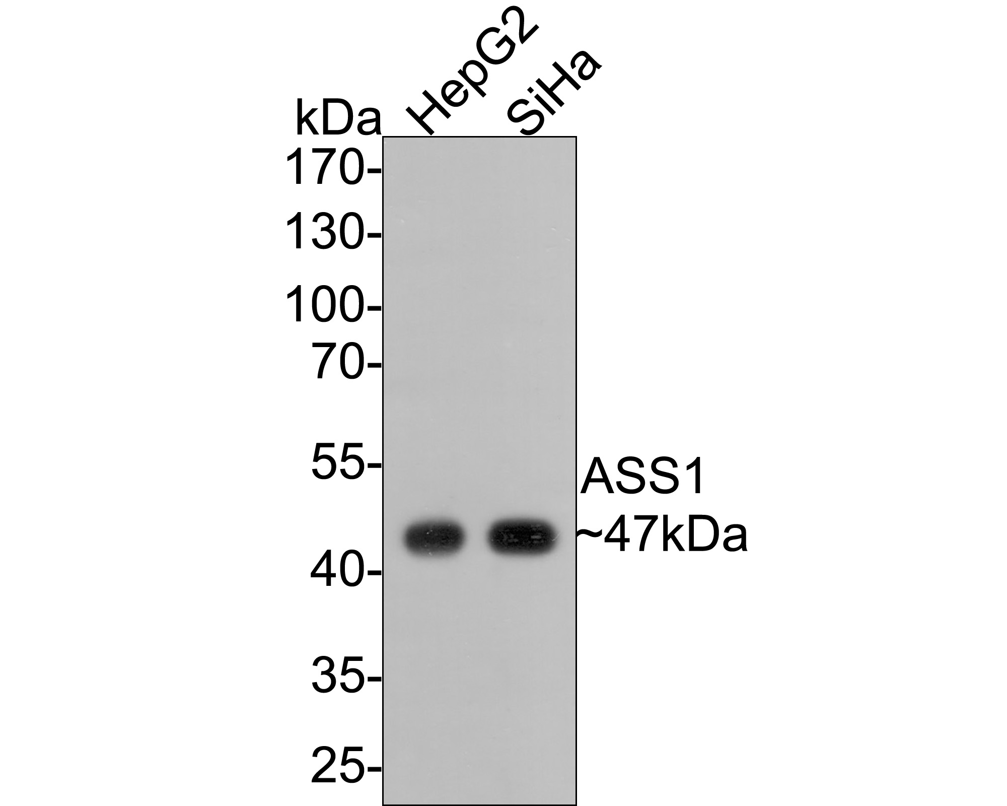 Western blot analysis of ASS1 on different lysates with Mouse anti-ASS1 antibody (EM1701-87) at 1/5,000 dilution.<br />
<br />
Lane 1: HepG2 cell lysate<br />
Lane 2: SiHa cell lysate<br />
<br />
Lysates/proteins at 10 µg/Lane.<br />
<br />
Predicted band size: 47 kDa<br />
Observed band size: 47 kDa<br />
<br />
Exposure time: 30 seconds;<br />
<br />
10% SDS-PAGE gel.<br />
<br />
Proteins were transferred to a PVDF membrane and blocked with 5% NFDM/TBST for 1 hour at room temperature. The primary antibody (EM1701-87) at 1/5,000 dilution was used in 5% NFDM/TBST at room temperature for 2 hours. Goat Anti-Mouse IgG - HRP Secondary Antibody (HA1006) at 1:100,000 dilution was used for 1 hour at room temperature.