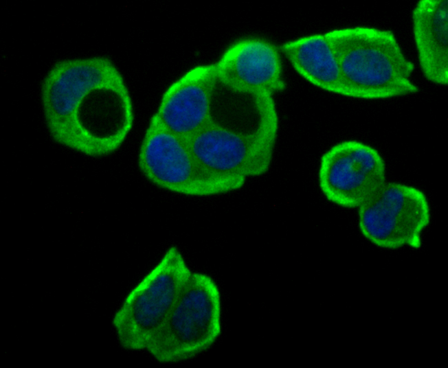 ICC staining ASS1 (green) in SiHa cells. The nuclear counter stain is DAPI (blue). Cells were fixed in paraformaldehyde, permeabilised with 0.25% Triton X100/PBS.