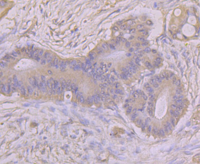 Immunohistochemical analysis of paraffin-embedded mouse testis tissue using anti-ASS1 antibody. Counter stained with hematoxylin.