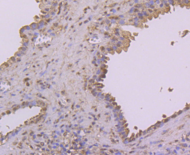 Immunohistochemical analysis of paraffin-embedded human prostate tissue using anti-NFIB/NF1B2 antibody. Counter stained with hematoxylin.