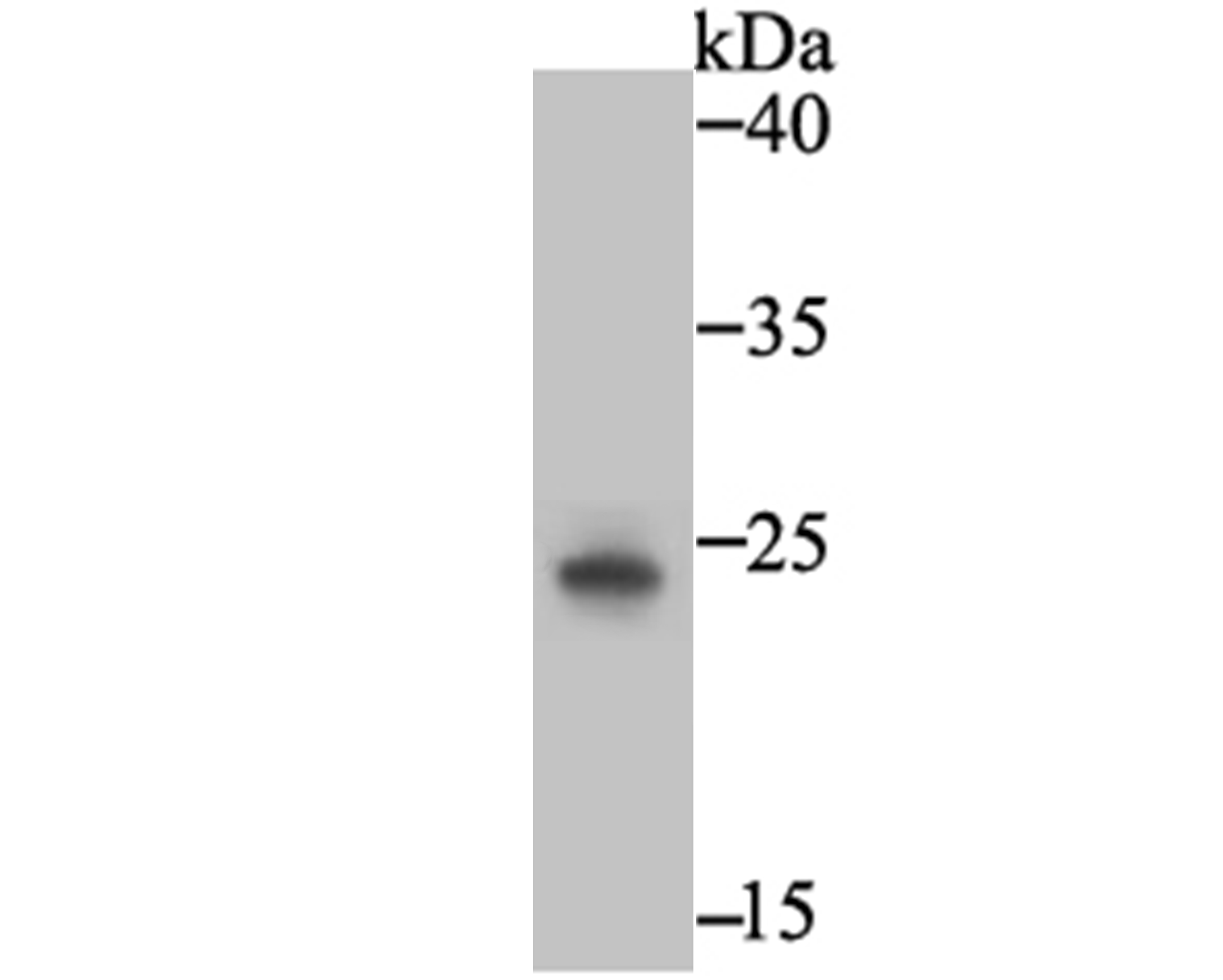 Western blot analysis of PLGF on JAR using anti-PLGF antibody at 1/500 dilution.