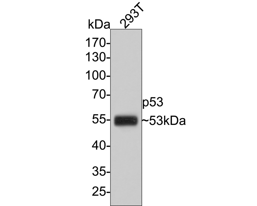 Western blot analysis of p53 on 293T cell lysates with Mouse anti-p53 antibody (EM1701-92) at 1/500 dilution.<br />
<br />
Lysates/proteins at 10 µg/Lane.<br />
<br />
Predicted band size: 53 kDa<br />
Observed band size: 53 kDa<br />
<br />
Exposure time: 1 minute;<br />
<br />
10% SDS-PAGE gel.<br />
<br />
Proteins were transferred to a PVDF membrane and blocked with 5% NFDM/TBST for 1 hour at room temperature. The primary antibody (EM1701-92) at 1/500 dilution was used in 5% NFDM/TBST at room temperature for 2 hours. Goat Anti-Mouse IgG - HRP Secondary Antibody (HA1006) at 1:100,000 dilution was used for 1 hour at room temperature.