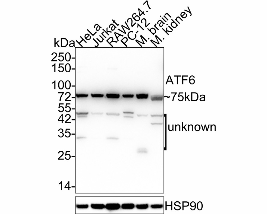 Western blot analysis of ATF6 on different lysates with Mouse anti-ATF6 antibody (EM1701-94) at 1/1,000 dilution.<br />
<br />
Lane 1: HeLa cell lysate (20 µg/Lane)<br />
Lane 2: Jurkat cell lysate (20 µg/Lane)<br />
Lane 3: RAW264.7 cell lysate (20 µg/Lane)<br />
Lane 4: PC-12 cell lysate (20 µg/Lane)<br />
Lane 5: Mouse brain tissue lysate (40 µg/Lane)<br />
Lane 6: Mouse kidney tissue lysate (40 µg/Lane)<br />
<br />
Predicted band size: 75 kDa<br />
Observed band size: 75 kDa<br />
<br />
Exposure time: 24 seconds;<br />
<br />
4-20% SDS-PAGE gel.<br />
<br />
Proteins were transferred to a PVDF membrane and blocked with 5% NFDM/TBST for 1 hour at room temperature. The primary antibody (EM1701-94) at 1/1,000 dilution was used in 5% NFDM/TBST at 4℃ overnight. Goat Anti-Mouse IgG - HRP Secondary Antibody (HA1006) at 1/50,000 dilution was used for 1 hour at room temperature.
