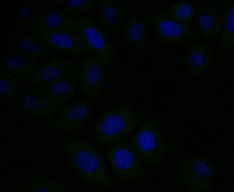 ICC staining ERp72 (green) in HepG2 cells. The nuclear counter stain is DAPI (blue). Cells were fixed in paraformaldehyde, permeabilised with 0.25% Triton X100/PBS.