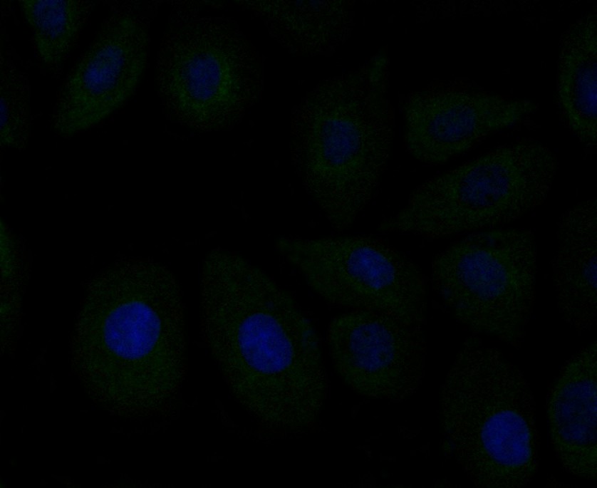 ICC staining ERp72 (green) in SKOV-3 cells. The nuclear counter stain is DAPI (blue). Cells were fixed in paraformaldehyde, permeabilised with 0.25% Triton X100/PBS.