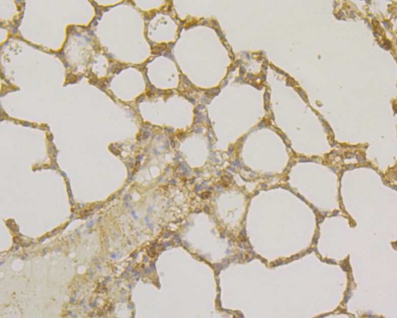 Immunohistochemical analysis of paraffin-embedded rat lung tissue using anti-Osteoprotegerin antibody. Counter stained with hematoxylin.