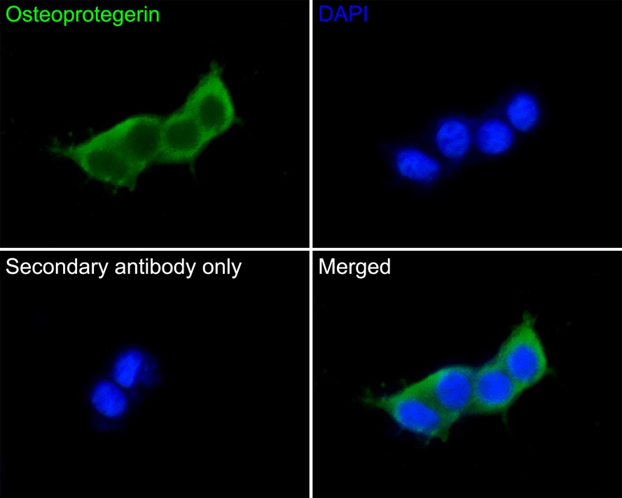 Immunocytochemistry analysis of 293 cells labeling Osteoprotegerin with Mouse anti-Osteoprotegerin antibody (EM1701-99) at 1/50 dilution.<br />
<br />
Cells were fixed in 4% paraformaldehyde for 30 minutes, permeabilized with 0.1% Triton X-100 in PBS for 15 minutes, and then blocked with 2% BSA for 30 minutes at room temperature. Cells were then incubated with Mouse anti-Osteoprotegerin antibody (EM1701-99) at 1/50 dilution in 2% BSA overnight at 4 ℃. Goat Anti-Mouse IgG H&L (iFluor™ 488, HA1125) was used as the secondary antibody at 1/1,000 dilution. PBS instead of the primary antibody was used as the secondary antibody only control. Nuclear DNA was labelled in blue with DAPI.