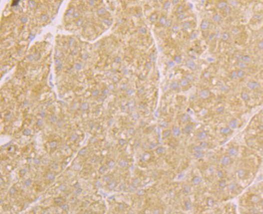 Immunohistochemical analysis of paraffin-embedded human liver tissue using anti-Osteoprotegerin antibody. Counter stained with hematoxylin.